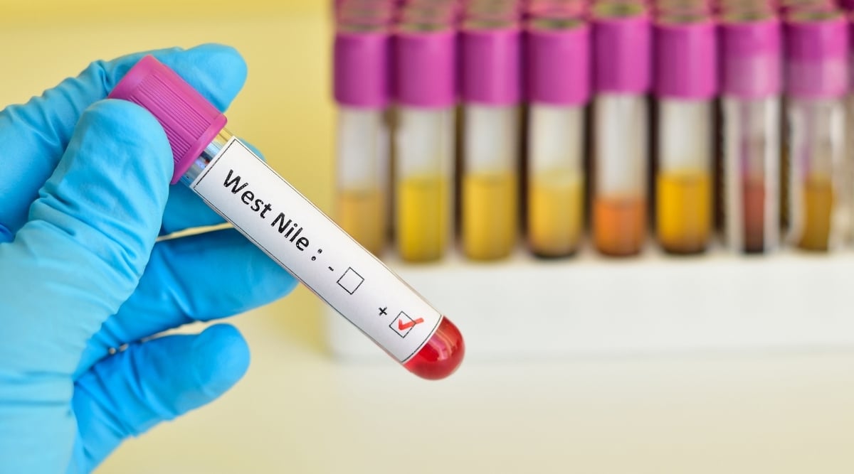 West Nile Virus Testing
