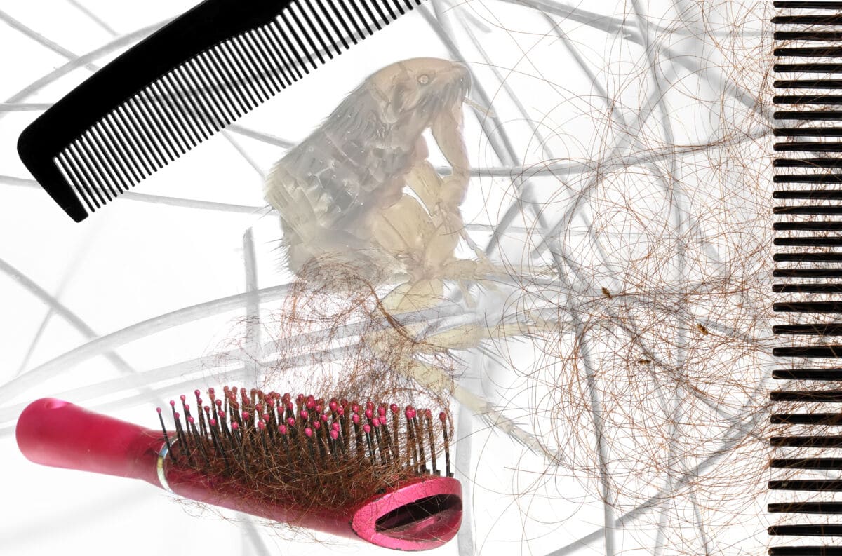 Collage of a bruh, comb, some hair and a magnified head louse