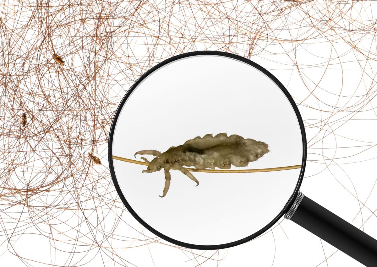 head lice under magnifying glass